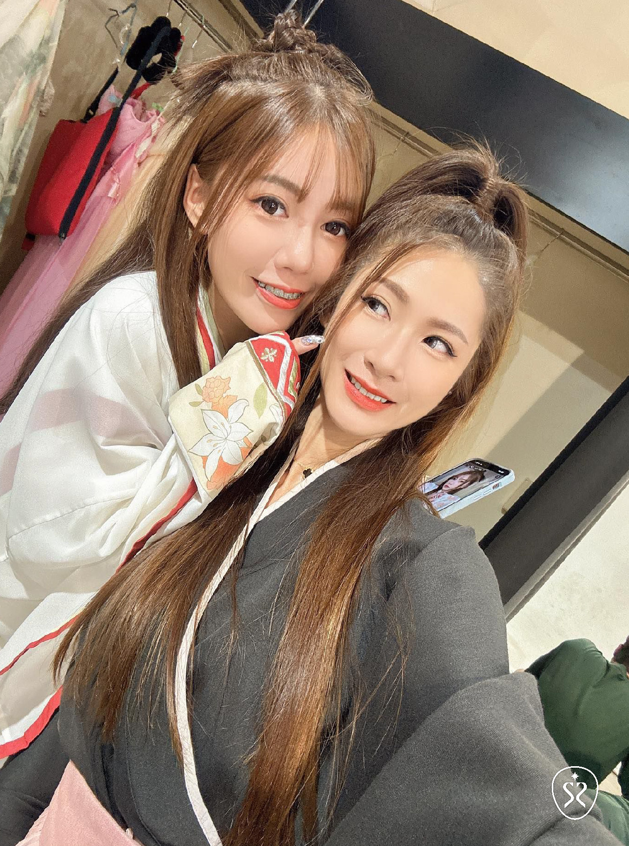 玻尿酸填補夫妻宮療程分享